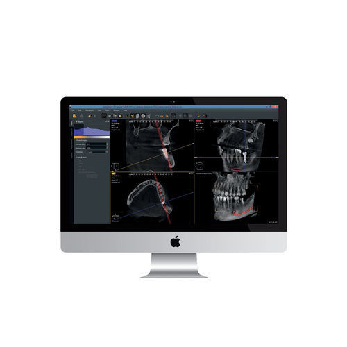 Медицинское программное обеспечение - Owandy Radiology - для стоматологической имплантологии / для обработки снимков зубов / для DICOM