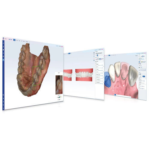 Модуль программного обеспечения для стоматологии - Romexis® CAD/CAM - Planmeca - для обработки снимков зубов / для ортодонтии / для стоматологических лабoраторий