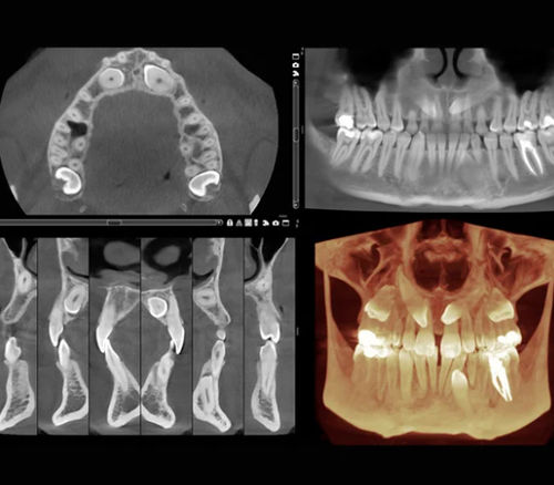 Медицинское программное обеспечение - Romexis® 3D - Planmeca - для хирургии / для стоматологии / эндодонтологическое