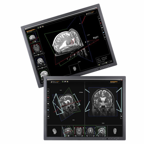 Программное обеспечение для предоперационного планирования - neuroinspire™ - Renishaw - медицинское / для стереотаксической хирургии / автоматизированное