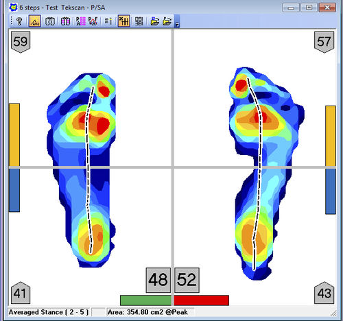 Программное обеспечение для лечения заболеваний стоп - FootMat™ Researchers - Tekscan - для анализа / для визуализации / для составления отчетности