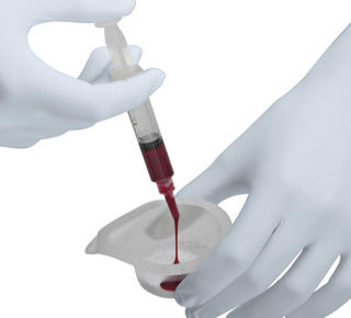 Синтетический костный заменитель - Ceros® TCP  - Thommen Medical AG   - для ортопедической хирургии / паста