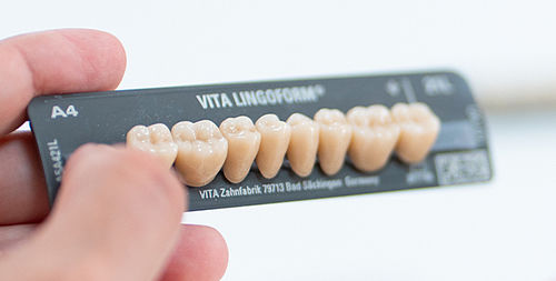 Стоматологический протез из композита - VITAPAN® LINGOFORM - VITA Zahnfabrik H. Rauter GmbH & Co.KG   - для задних зубов