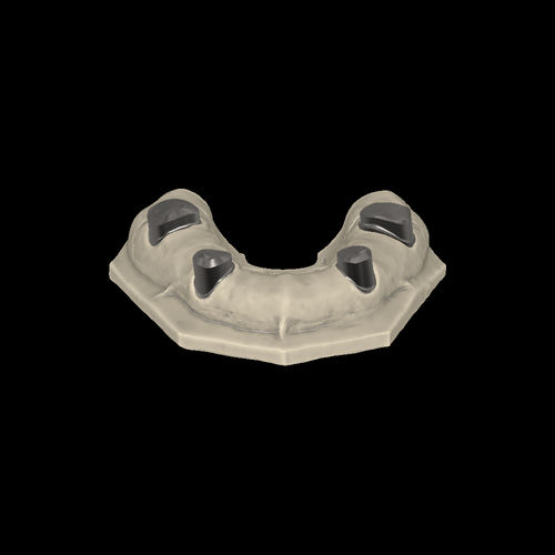 Модуль программного обеспечения для стоматологических лабoраторий - Telescopic crowns - Zirkonzahn - CAO / для проектирования зубных протезов / FAO