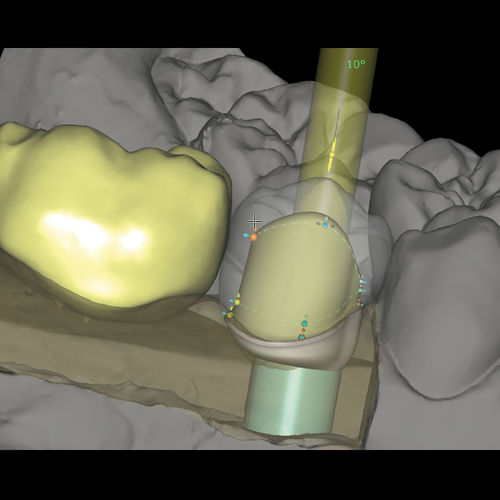 Модуль программного обеспечения для стоматологических лабoраторий - CAD/CAM Abutments - Zirkonzahn - для проектирования зубных протезов / для производственного процесса