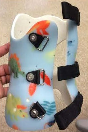 Грудной пояснично-крестцовый поддерживающий корсет - Boston Orthotics + Prosthetics - педиатрический / для сколиоза