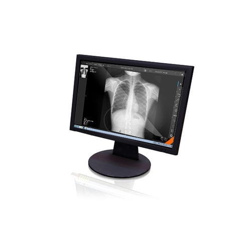Программное обеспечение для визуализации - Xview4 - GEMSS Medical Systems - для рентгенологии / для планшетного ПК