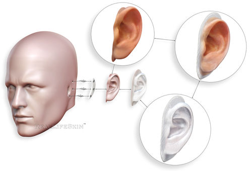 Ушной эстетический протез - RealLifeSkin™ - RealLifeSkin - для взрослых