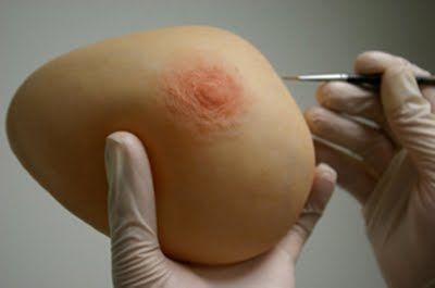 Грудной эстетический протез - The Anaplastology Clinic - для взрослых