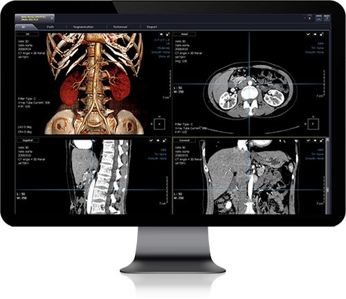 Программное обеспечение для моделирования зубного импланта - Xelis - Infinitt Healthcare - для составления отчетности / для визуализации / для диагностики
