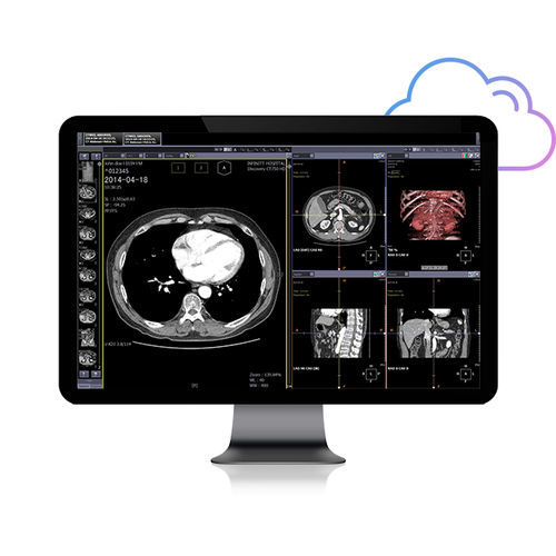 PACS с данными из интернета - Smart Net - Infinitt Healthcare - медицинская