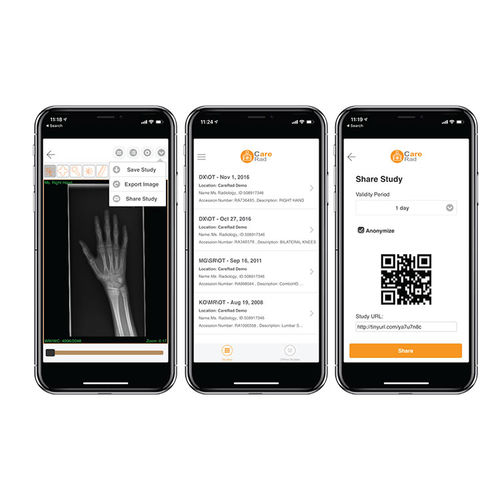 Программное обеспечение для обмена информацией - CareRad - PaxeraHealth Corp - для анализа изображений / для управления / для контроля