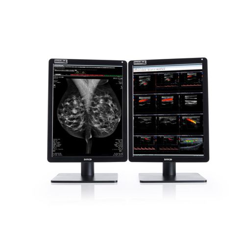 Медицинский монитор - MDNC-6121 - Barco - для диагностики / для рентгенологии / маммографический