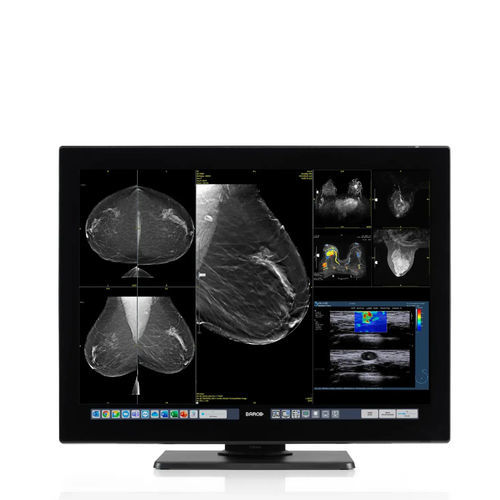 Медицинский монитор - Coronis OneLook - Barco - для рентгенологии / маммографический / дистанционный
