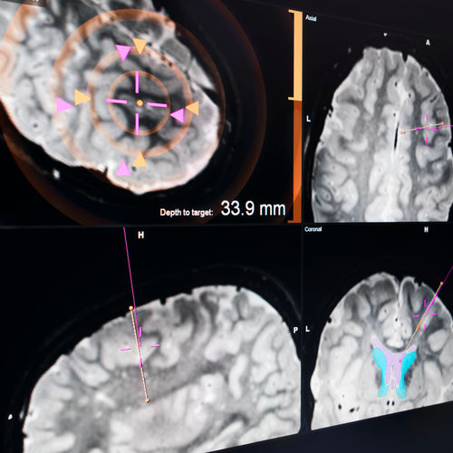 Программное обеспечение для больниц - EM - Brainlab - для нейрохирургии / для контроля / калибровки