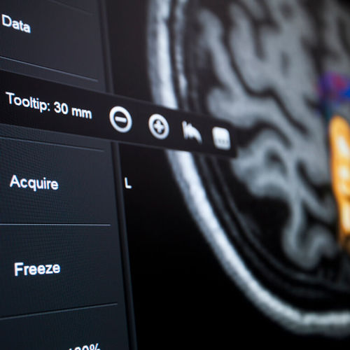 Программное обеспечение для больниц - Brainlab - для нейрохирургии / для контроля / для визуализации