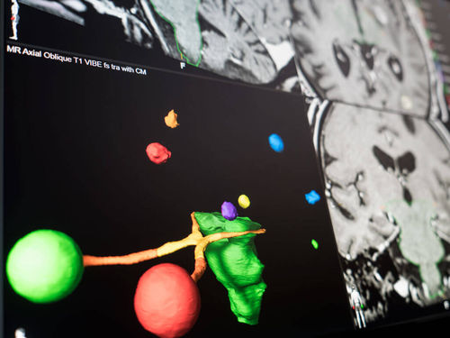 Программное обеспечение для визуализации - Brainlab - для предоперационного планирования / для планирования лечения / для обработки