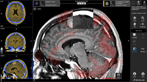 Медицинское программное обеспечение - Brainlab - неврологическое / для планирования / для планирования лечения