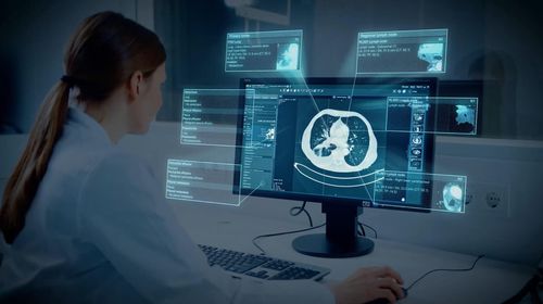 Программное обеспечение для обработки - Brainlab - с системой отслеживания / медицинское / легкого