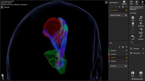 Медицинское программное обеспечение - Elements  - Brainlab - для нейрохирургии / неврологическое / для анализа
