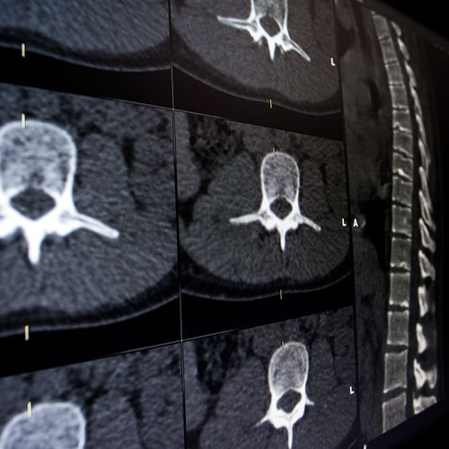 Медицинское программное обеспечение - Brainlab - для хирургии позвоночника / неврологическое / для визуализации