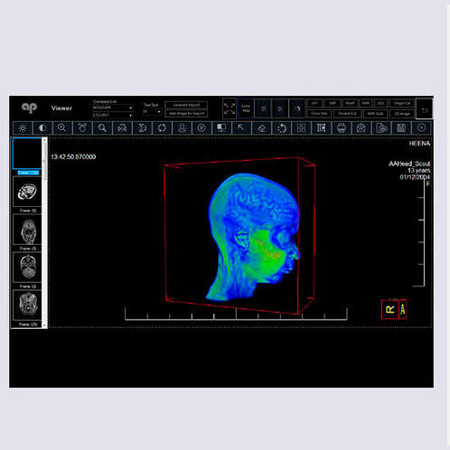 PACS для медицинских снимков - Allengers Medical Systems