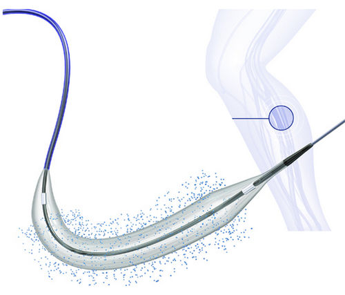 Катетер PTA - BIOPATH™ 014 - Biosensors International - периферийный / артериальный / бедренная артерия