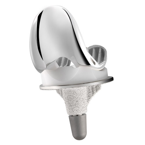 Коленный протез с 3 отсеками - MC2® UC - C2F Implants - с подвижным вкладышем / с цементом или без цемента