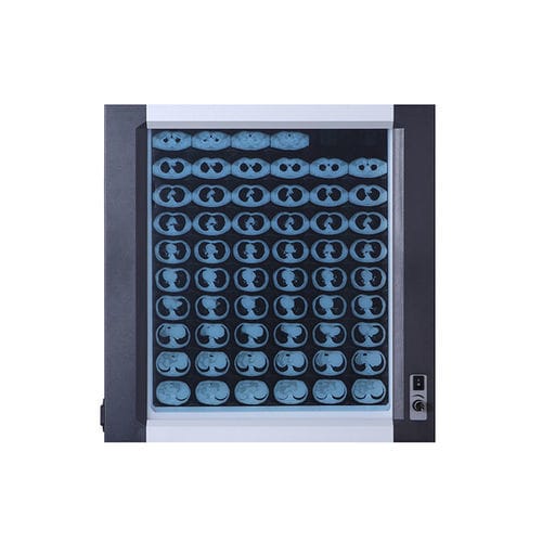 Негатоскоп 1 диапазон - Jiangsu Dengguan Medical Treatment Instrument - светодиод