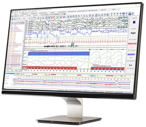 Программное обеспечение для управления - SleepWorks™ - Natus Medical - для анализа / для диагностики / для обработки