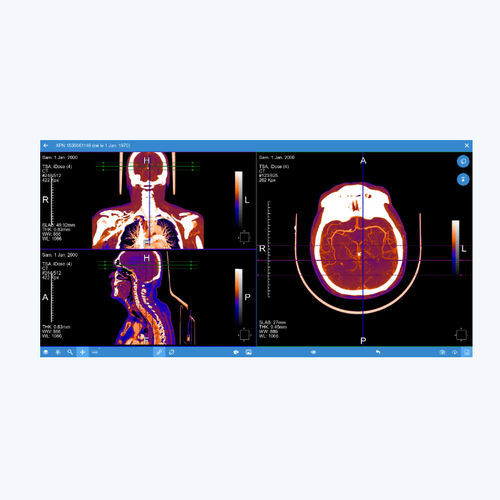 PACS для медицинских снимков - EVOLUCARE