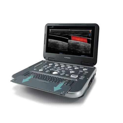 Переносной ультразвуковой сканер - E-CUBE i7 - Alpinion Medical Systems - для поливалентной эхографии / цветовой допплер / со встроенной консолью