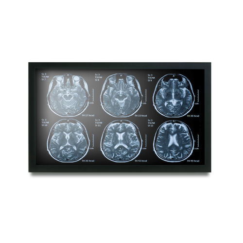 Медицинский монитор - MEDDP-622 - Onyx Healthcare Inc - 19" / LCD / со светодиодной подсветкой