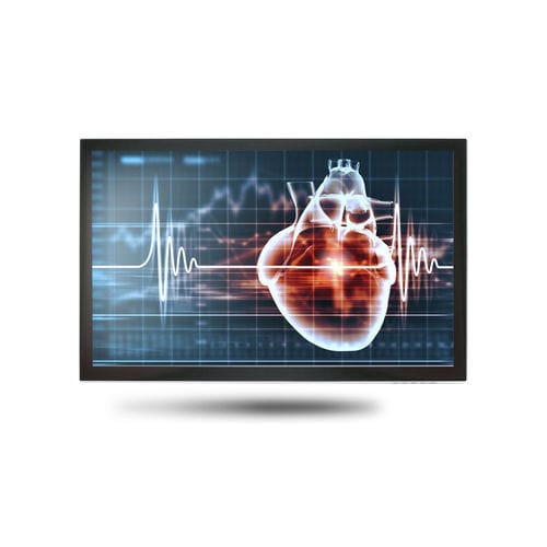 Медицинский монитор - MEDDP-615 - Onyx Healthcare Inc - 18,5" / LCD / со светодиодной подсветкой