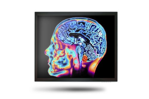 Медицинский монитор - MEDDP-415 - Onyx Healthcare Inc - 17" / LCD / со светодиодной подсветкой