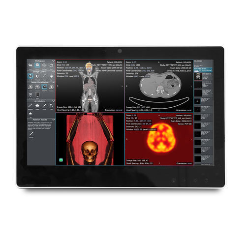 Панельный медицинский ПК Intel® Celeron® - SMA-1533 - Onyx Healthcare Inc - Intel® Atom Dual Core / для отделения интенсивной терапии / для компьютерной тележки