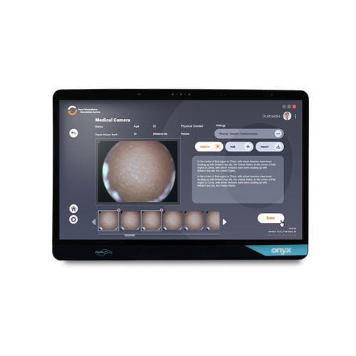 Медицинский ПК Intel® Core™ - Venus-244 - Onyx Healthcare Inc - Intel® Tiger Lake i7 / Intel® Tiger Lake i5 / TPM Windows 11