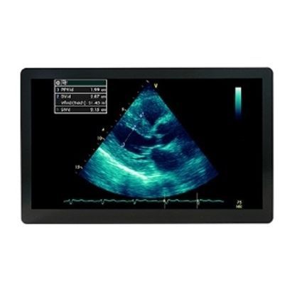 Монитор для ультразвуковых исследований - MSBP2416AMC - Avalue Healthcare - хирургический / 1920x1080 / 24"