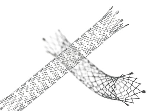 Венозный стент -  E-LUMINEXX® - Bard Medical