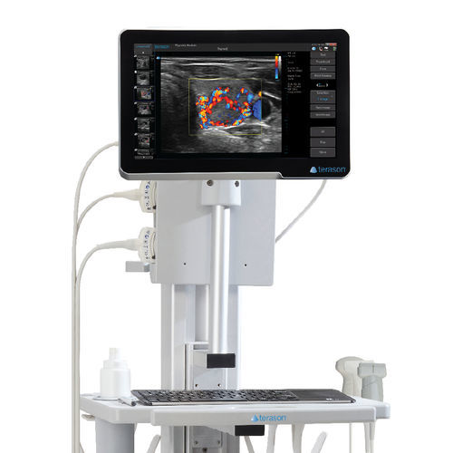 Ультразвуковой сканер переносной, с тележкой - uSmart® 3200T Plus - Terason - для поливалентной эхографии / черно-белый / цветовой допплер