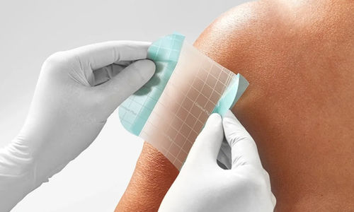 Прозрачная повязка для защиты кожи - Comfeel® Plus - Coloplast - гидроколлоидная / способствует заживлению