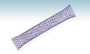 Колоректальный стент - HANAROSTENT® NNN - M.I Tech