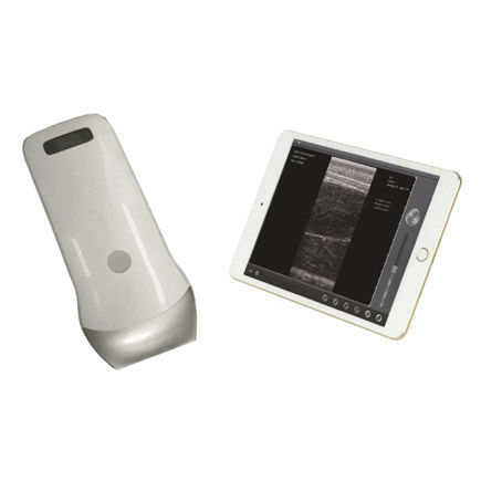 Портативный ветеринарный ультразвуковой сканер - UProbe-2B - Sonostar Technologies - многоцелевой / для кошек / беспроводной зонд