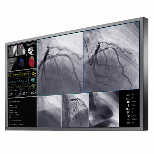 Монитор для медицинских снимков - LL550W - EIZO GmbH - для рентгенологии / для ангиографии / для операционной