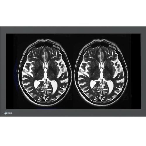 Медицинский монитор - LX3240-MR - EIZO GmbH - Full HD / разрешение 4K / 16:9