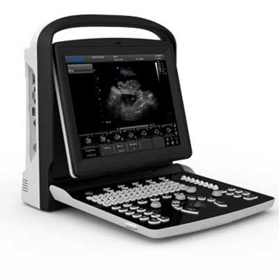 Переносной ветеринарный ультразвуковой сканер - Chison Eco3 - Diagnostic Imaging Systems - многоцелевой / для небольших животных / для крупных животных