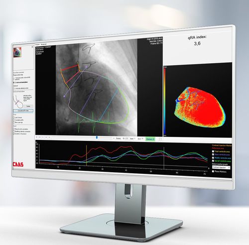 Программное обеспечение для анализа изображений - Pie Medical Imaging - для диагностики / для измерений / для планирования лечения