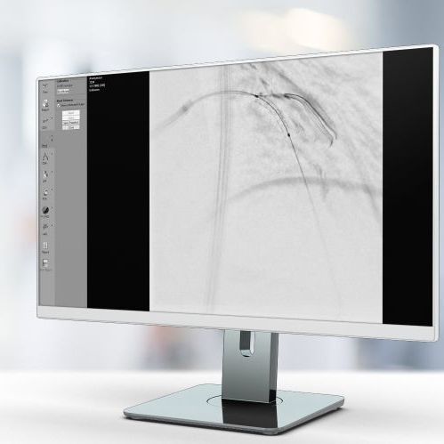 Программное обеспечение для улучшения изображений - StentEnhancer - Pie Medical Imaging - для визуализации / медицинское / для кардиологии