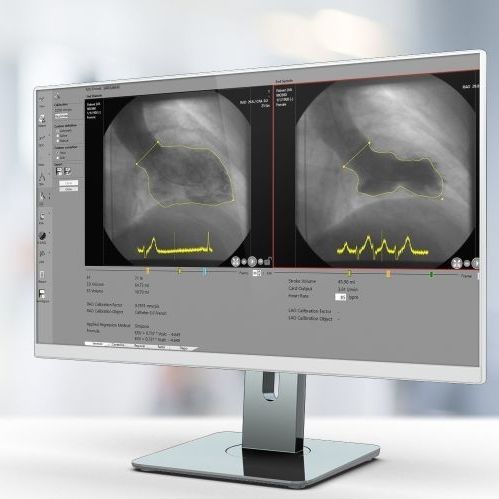 Программное обеспечение для медицинских снимков - RVA - Pie Medical Imaging - для кардиологии / для анализа / для составления отчетности