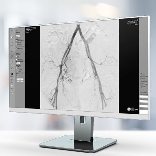 Программное обеспечение для ангиографии - QVA - Pie Medical Imaging - для кардиологии / для анализа / для составления отчетности
